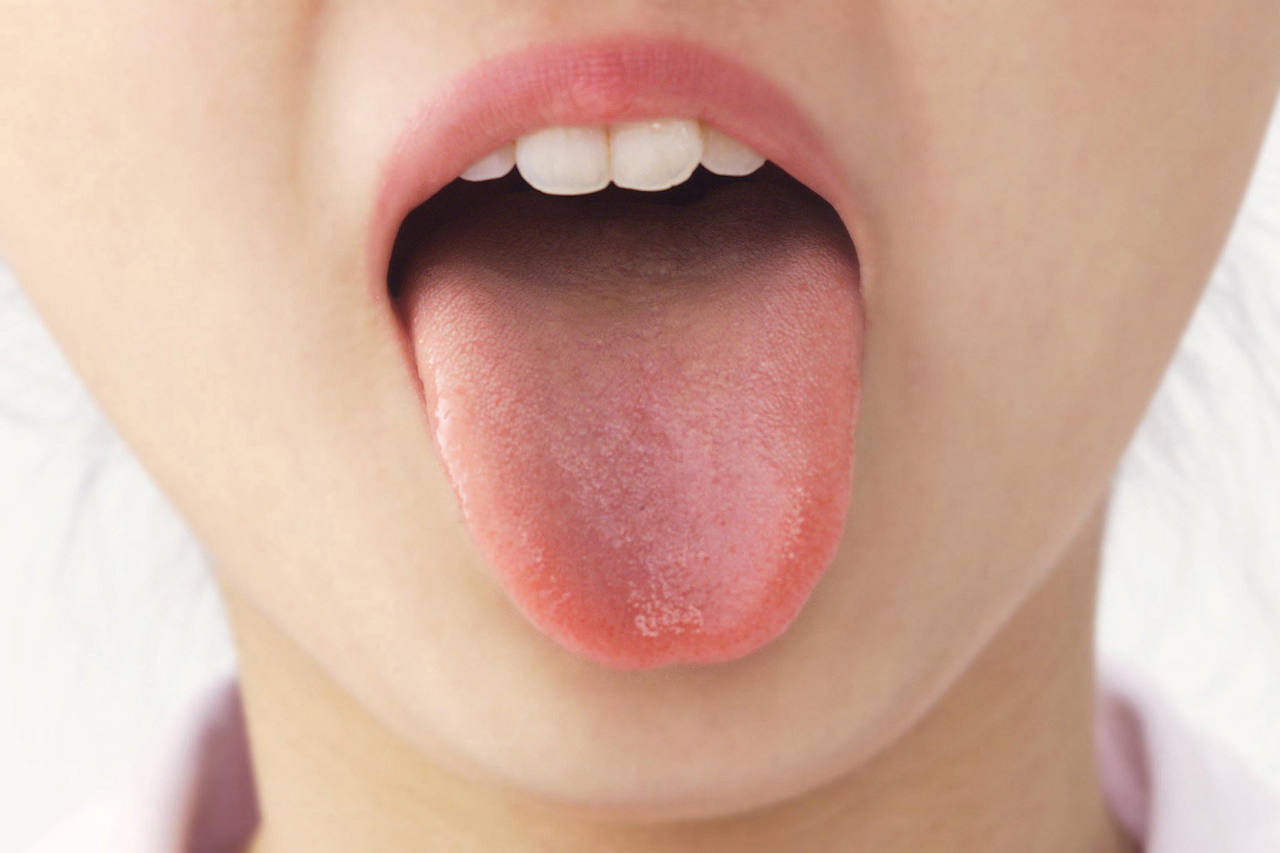 正常舌头根部照片,正常人的舌头根部照片 - 伤感说说吧