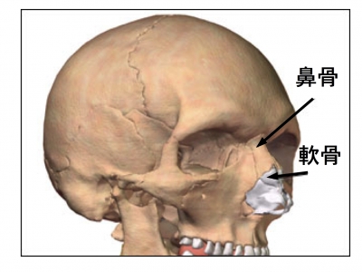 鼻骨骨折の症状・診断・治療 骨・筋肉・関節の病気 All About