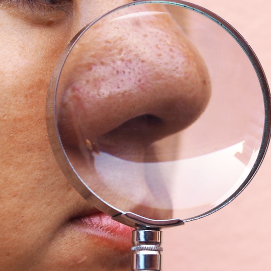 今すぐTRY！毛穴タイプ診断